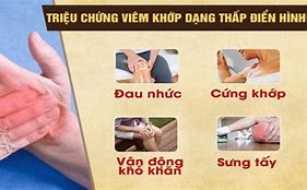 Cách Điều Trị Viêm Khớp Dạng Thấp